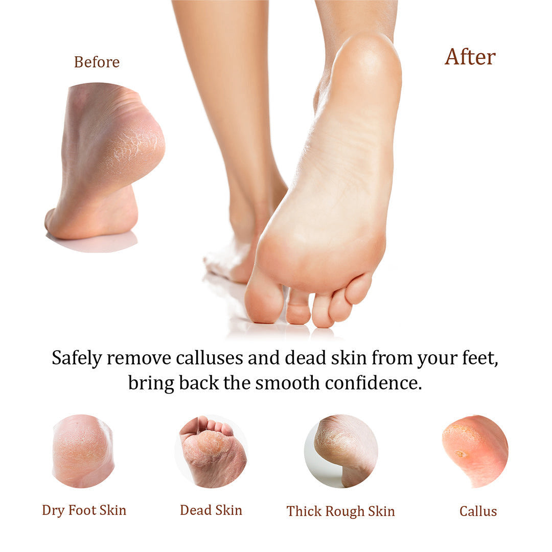 Be Natural Callus Eliminator #21380 (34oz)